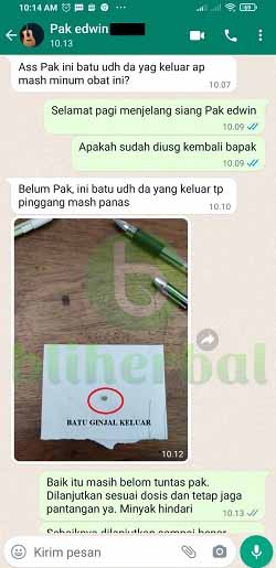 edwin batu ginjal